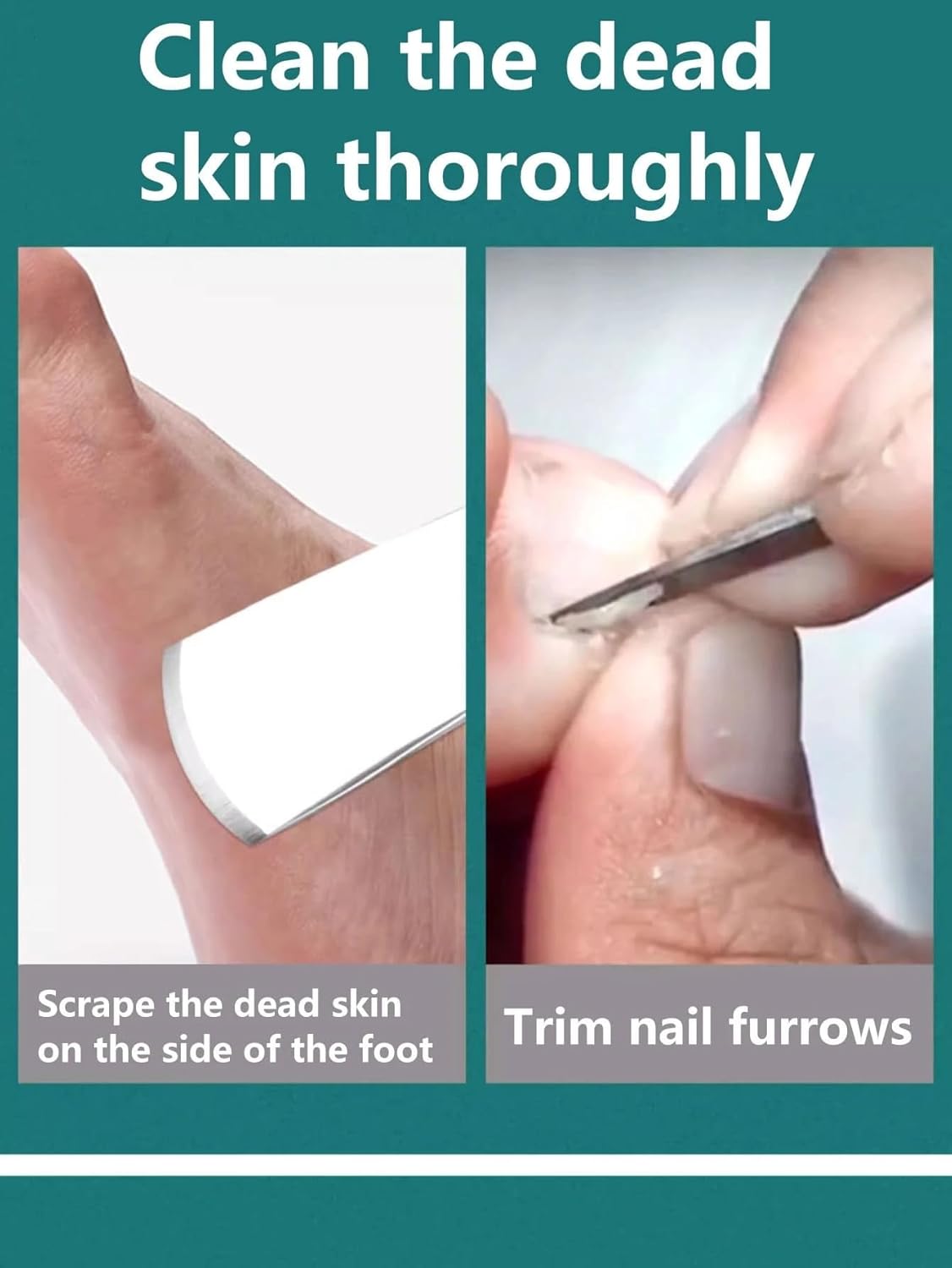 Pedicure Knife Set 5 Pcs Foot Callus Dead Skin Corn Remover Tools