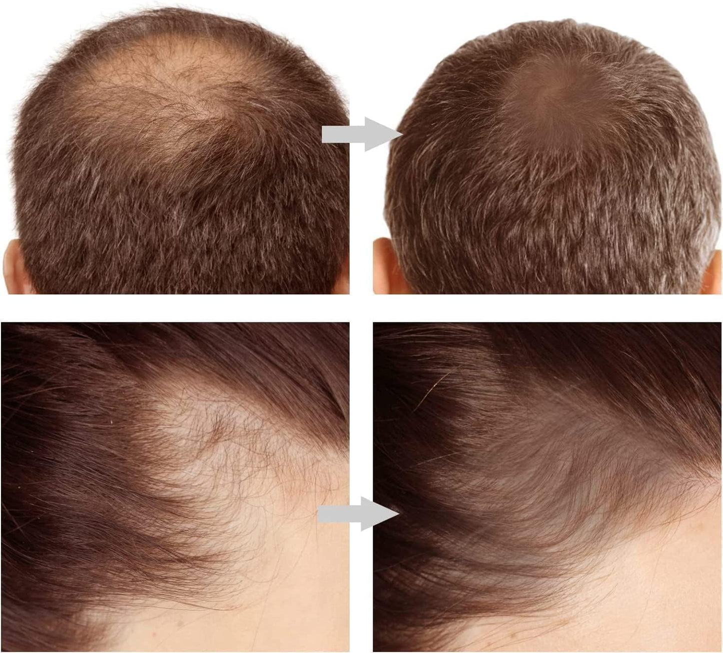 Natural Hairline Powder Stick | Quick Hair Root Touch-Up for Gray Hair | Sweatproof & Waterproof Hair Filler Powder